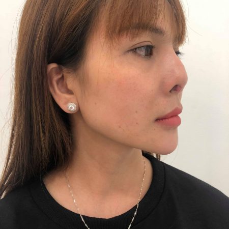 khach hang phuong binh sau khi nang mui