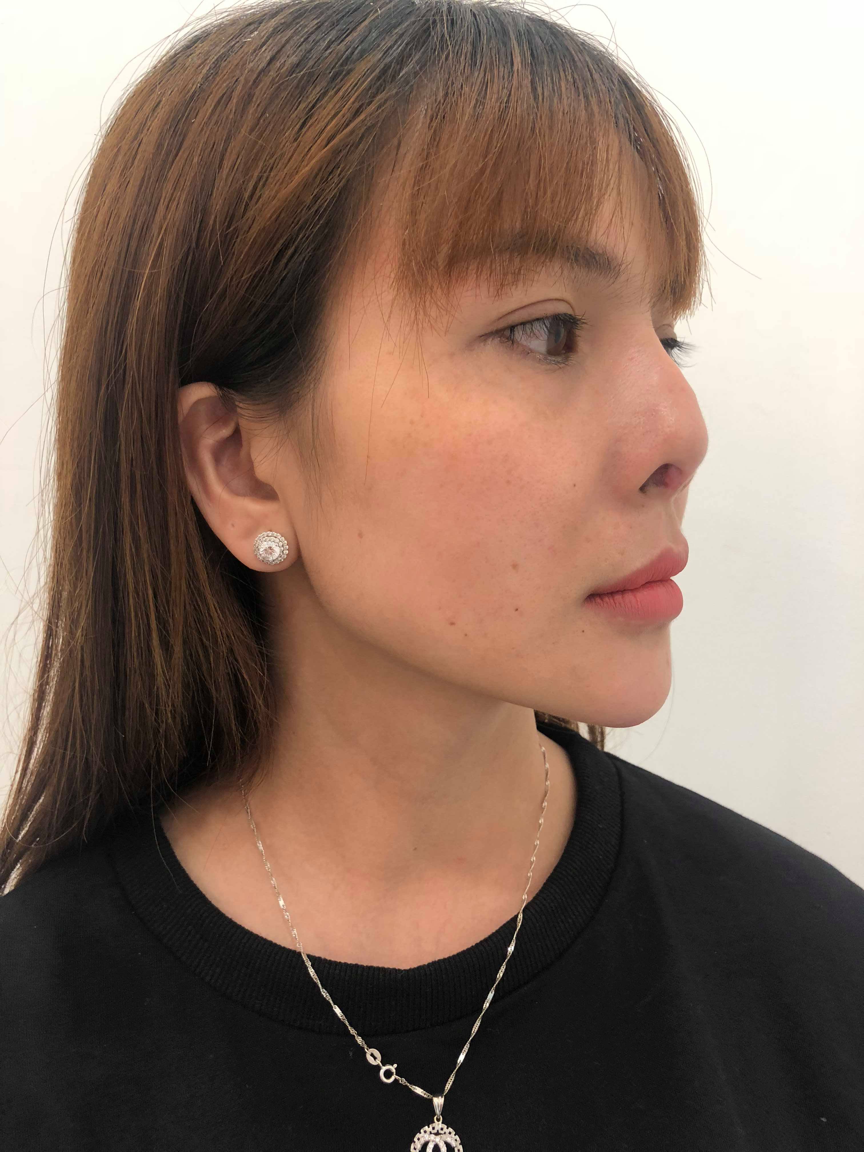 khach hang phuong binh sau khi nang mui