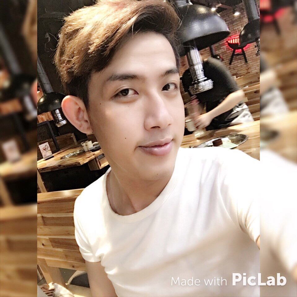 Chàng trai chi gần 100 triệu đồng phẫu thuật nâng mũi và cái kết