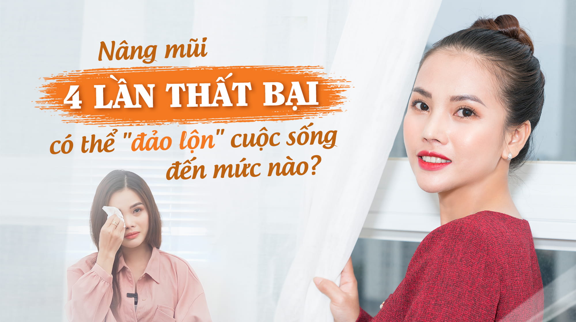 4 lần nâng mũi thất bại có thể “đảo lộn” cuộc sống của bạn đến mức nào?